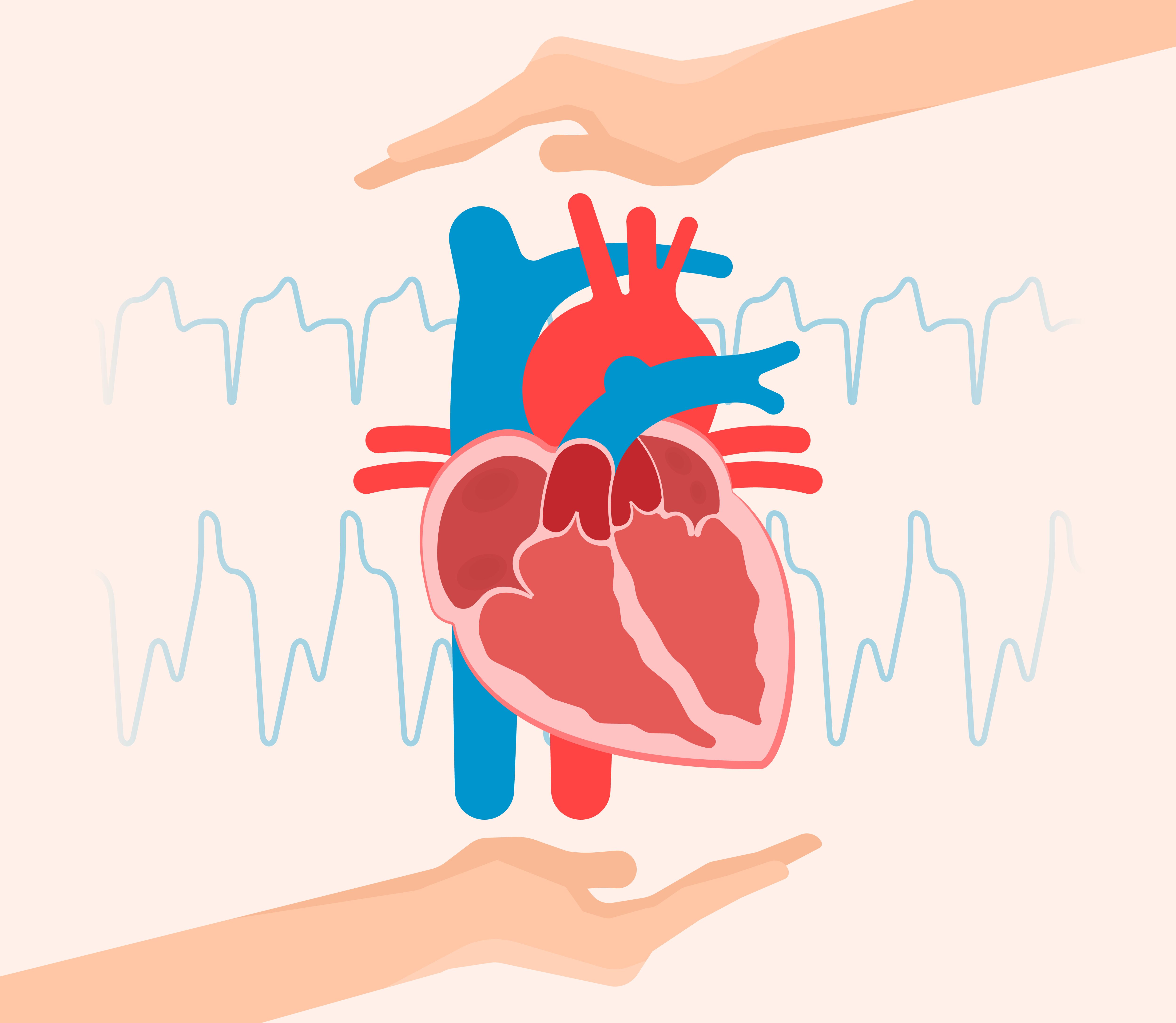 How to Stop an AFib Attack: Key Tips