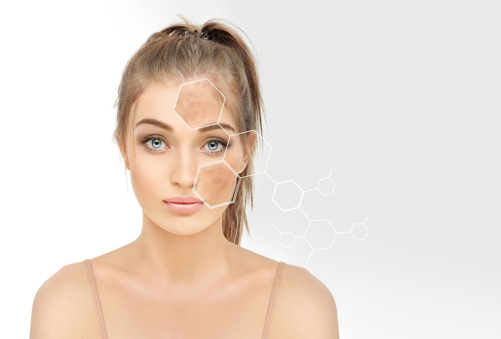 Hyperpigmentation Treatment Nearby